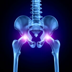 Pain in the hip joints can be acute, painful or chronic