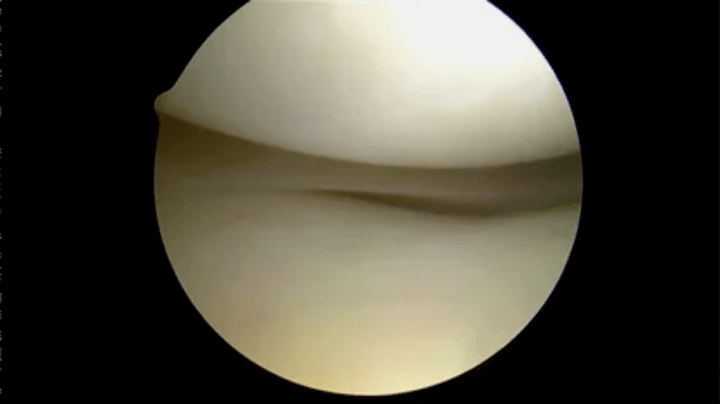 astroscopic view of perfectly healthy surfaces
