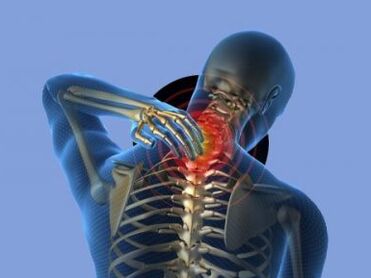 Neck pain bothers a person with osteochondrosis of the cervical spine